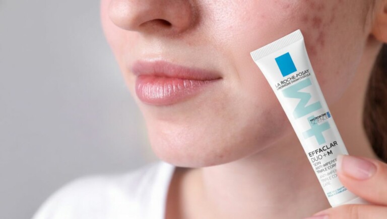 Comment enlever les tâches de boutons sur le visage rapidement ?